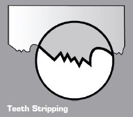 Teeth Stripping